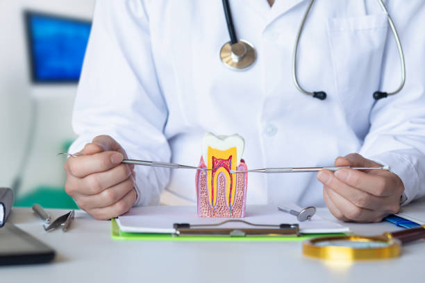 Best Knocked-Out Tooth (Avulsed Tooth) Treatment in Menifee, CA